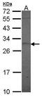 Prolactin antibody, PA5-29925, Invitrogen Antibodies, Western Blot image 