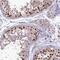 Testis-specific Y-encoded-like protein 2 antibody, HPA044133, Atlas Antibodies, Immunohistochemistry paraffin image 