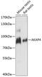 AKAP4 antibody, GTX66294, GeneTex, Western Blot image 