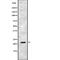 Interferon Alpha 17 antibody, abx216270, Abbexa, Western Blot image 