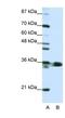 Heterogeneous Nuclear Ribonucleoprotein A1 antibody, NBP1-57121, Novus Biologicals, Western Blot image 