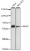 Pyruvate Kinase M1/2 antibody, 22-748, ProSci, Western Blot image 