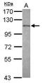 Exosome Component 10 antibody, PA5-28589, Invitrogen Antibodies, Western Blot image 