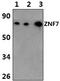 Zinc Finger Protein 7 antibody, PA5-75924, Invitrogen Antibodies, Western Blot image 