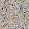 Fascin Actin-Bundling Protein 1 antibody, MAB7745, R&D Systems, Immunohistochemistry frozen image 