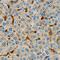 FSCN1 antibody, MAB7745, R&D Systems, Immunohistochemistry frozen image 