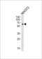 Receptor Like Tyrosine Kinase antibody, GTX25513, GeneTex, Western Blot image 