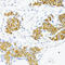 Fibronectin 1 antibody, LS-C748003, Lifespan Biosciences, Immunohistochemistry paraffin image 