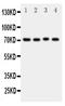 ATP Binding Cassette Subfamily G Member 2 (Junior Blood Group) antibody, PA1870, Boster Biological Technology, Western Blot image 