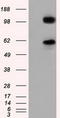 Transforming Acidic Coiled-Coil Containing Protein 3 antibody, CF501253, Origene, Western Blot image 