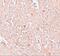 F-Box And Leucine Rich Repeat Protein 16 antibody, A15331, Boster Biological Technology, Immunohistochemistry frozen image 