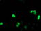 Protein SSX1 antibody, TA502724, Origene, Immunofluorescence image 