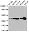 Adenosine Kinase antibody, LS-C669675, Lifespan Biosciences, Western Blot image 