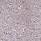 Tensin 1 antibody, PA5-57516, Invitrogen Antibodies, Immunohistochemistry paraffin image 