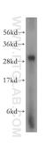 Phospholysine Phosphohistidine Inorganic Pyrophosphate Phosphatase antibody, 15759-1-AP, Proteintech Group, Western Blot image 