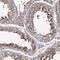 Nicastrin antibody, HPA054846, Atlas Antibodies, Immunohistochemistry paraffin image 