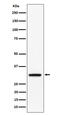 Phospholipid Scramblase 3 antibody, M10575, Boster Biological Technology, Western Blot image 