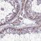 Proteasome 26S Subunit, Non-ATPase 11 antibody, NBP1-82700, Novus Biologicals, Immunocytochemistry image 