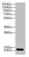 S100 Calcium Binding Protein A4 antibody, LS-C318024, Lifespan Biosciences, Western Blot image 