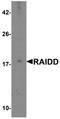 CASP2 And RIPK1 Domain Containing Adaptor With Death Domain antibody, NBP1-77048, Novus Biologicals, Western Blot image 
