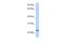 ChaC Glutathione Specific Gamma-Glutamylcyclotransferase 1 antibody, GTX20259, GeneTex, Western Blot image 