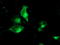 Tubulin Folding Cofactor C antibody, M06952-1, Boster Biological Technology, Immunofluorescence image 