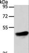 Adiponectin Receptor 1 antibody, LS-C403805, Lifespan Biosciences, Western Blot image 
