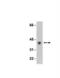 Leucine Carboxyl Methyltransferase 1 antibody, NBP2-29744, Novus Biologicals, Western Blot image 