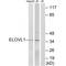 ELOVL Fatty Acid Elongase 1 antibody, A07612, Boster Biological Technology, Western Blot image 