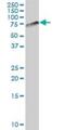 Kinesin Light Chain 4 antibody, H00089953-B01P, Novus Biologicals, Western Blot image 