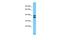 Serine Protease 55 antibody, A15037, Boster Biological Technology, Western Blot image 