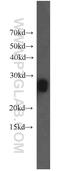Mitochondrial Intermediate Peptidase antibody, 17977-1-AP, Proteintech Group, Western Blot image 