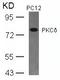 Protein Kinase C Delta antibody, GTX50605, GeneTex, Western Blot image 