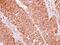 Eukaryotic Translation Initiation Factor 2 Subunit Beta antibody, NBP2-16290, Novus Biologicals, Immunohistochemistry paraffin image 