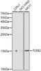 Elongin B antibody, GTX66010, GeneTex, Western Blot image 