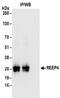 Receptor Accessory Protein 4 antibody, NBP2-30361, Novus Biologicals, Immunoprecipitation image 