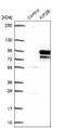 Kinesin Family Member 2B antibody, NBP1-86416, Novus Biologicals, Western Blot image 