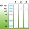 NPHS1 Adhesion Molecule, Nephrin antibody, M01991, Boster Biological Technology, Western Blot image 