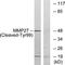 Matrix Metallopeptidase 27 antibody, LS-C121092, Lifespan Biosciences, Western Blot image 