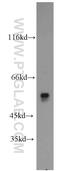 3-Oxoacid CoA-Transferase 2 antibody, 17122-1-AP, Proteintech Group, Western Blot image 
