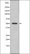 Lipase E, Hormone Sensitive Type antibody, orb335694, Biorbyt, Western Blot image 
