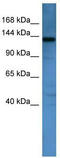 AF4/FMR2 family member 1 antibody, TA329752, Origene, Western Blot image 