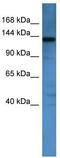 AF4/FMR2 Family Member 1 antibody, TA329752, Origene, Western Blot image 