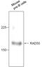 RAD50 Double Strand Break Repair Protein antibody, PA1-16531, Invitrogen Antibodies, Western Blot image 