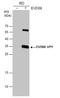 Enterovirus antibody, GTX132312, GeneTex, Western Blot image 