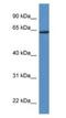 Homeobox protein Hox-D3 antibody, NBP1-74094, Novus Biologicals, Western Blot image 