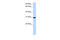 Ring Finger Protein 182 antibody, 25-865, ProSci, Enzyme Linked Immunosorbent Assay image 