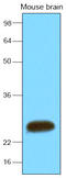 Synaptosome Associated Protein 25 antibody, LS-C93796, Lifespan Biosciences, Western Blot image 