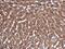 Mevalonate Diphosphate Decarboxylase antibody, GTX111425, GeneTex, Immunohistochemistry paraffin image 