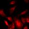 Protein Phosphatase 1 Catalytic Subunit Alpha antibody, LS-C668017, Lifespan Biosciences, Immunofluorescence image 
